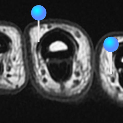 finger MRI